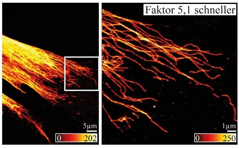 Ultrahochauflösende Fluoreszenzmikroskopie wird deutlich schneller